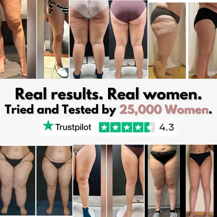 3D legging - say goodbye to lipedema pain and swelling naturally