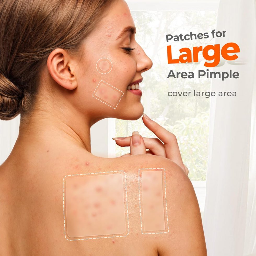 Large Pimple Patches for Face & Body Zit Breakouts (126 Count)