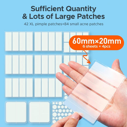 Large Pimple Patches for Face & Body Zit Breakouts (126 Count)