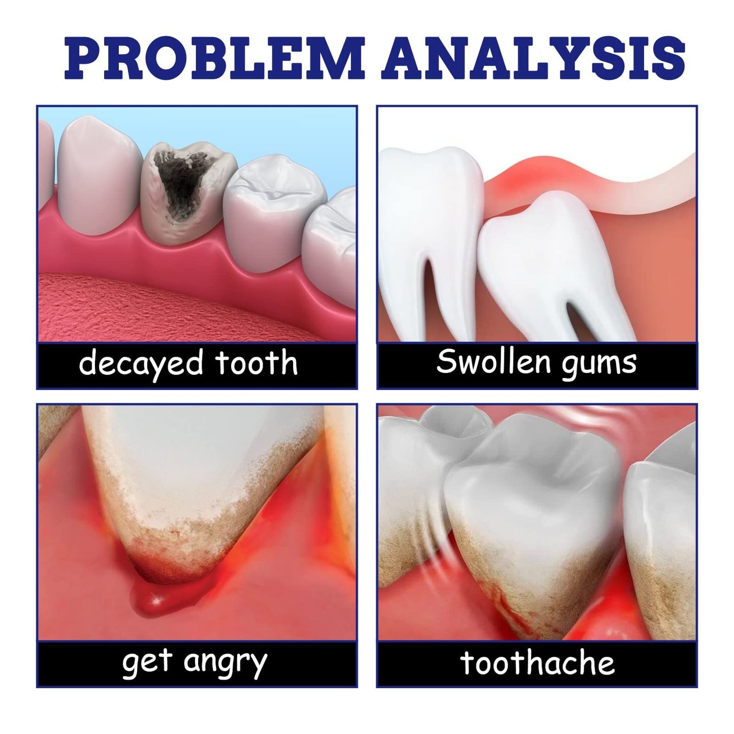 Fast-Acting Tooth Discomfort Relief Spray for Gums & Wisdom Tooth Pressure