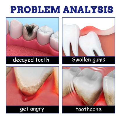 Fast-Acting Tooth Discomfort Relief Spray for Gums & Wisdom Tooth Pressure