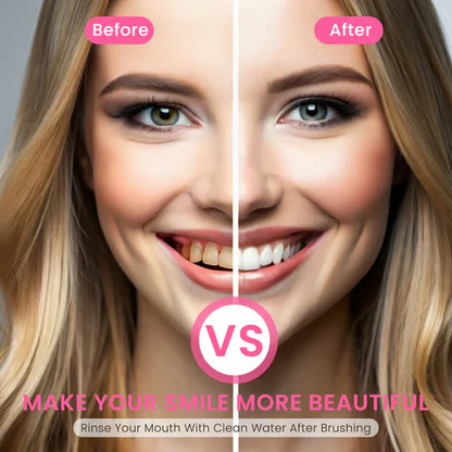 Probiotic Whitening Toothpaste – Fluoride-Free Brightening & Anti-Plaque Care