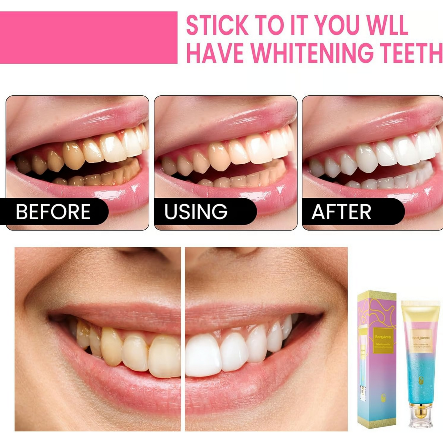 Probiotic Whitening Toothpaste – Fluoride-Free Brightening & Anti-Plaque Care