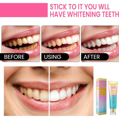 Probiotic Whitening Toothpaste – Fluoride-Free Brightening & Anti-Plaque Care